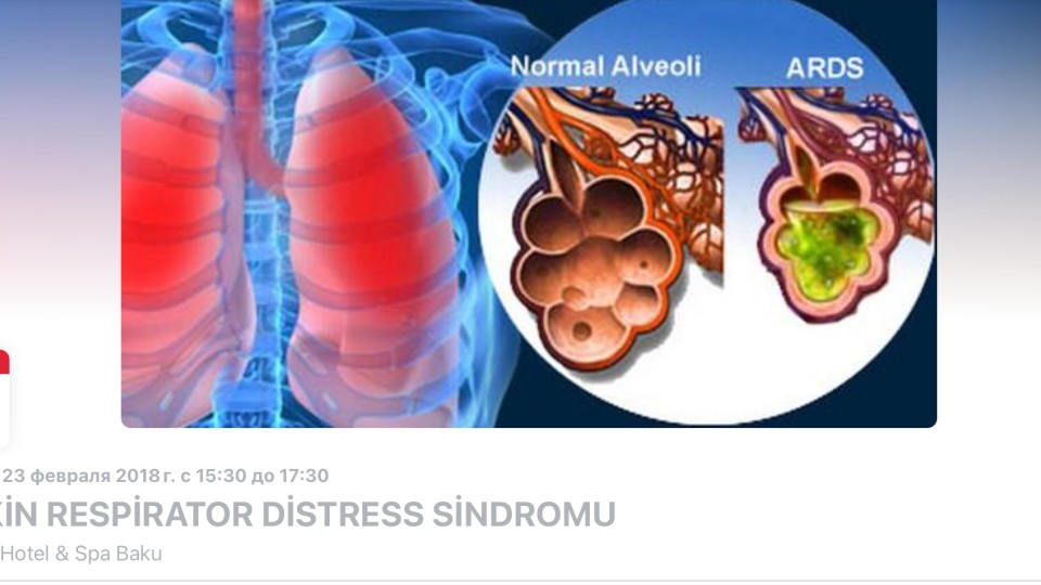"Kəskin respirator distress sindromu"