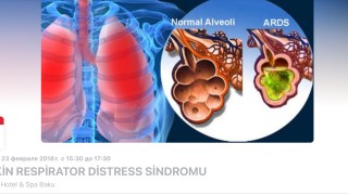 "Kəskin respirator distress sindromu"